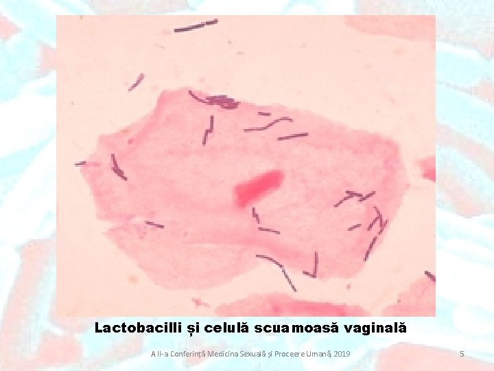 Lactobacilli și celulă scuamoasă vaginală A II-a Conferință Medicina Sexuală și Proceere Umană, 2019