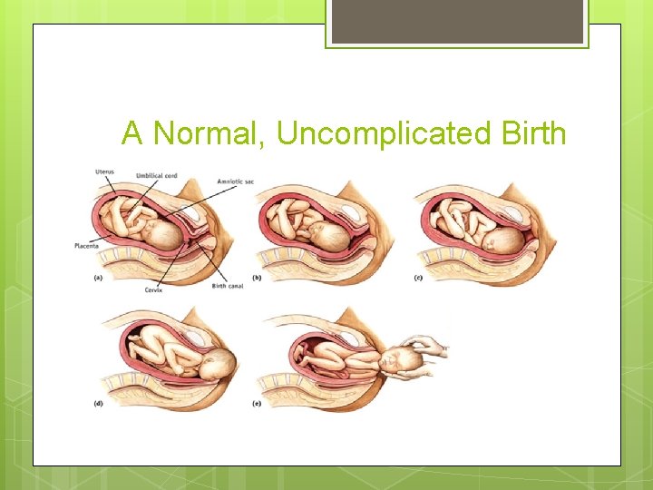 A Normal, Uncomplicated Birth 