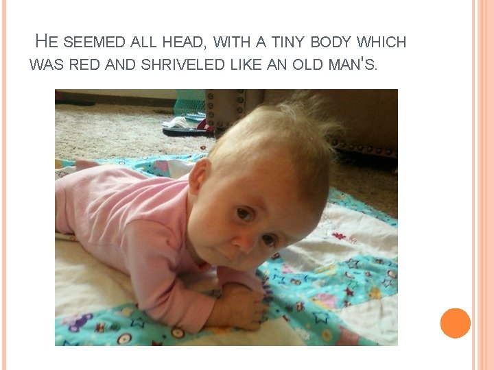  HE SEEMED ALL HEAD, WITH A TINY BODY WHICH WAS RED AND SHRIVELED