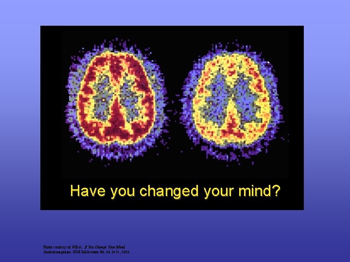 Have you changed your mind? Photo courtesy of NIDA. If You Change Your Mind.