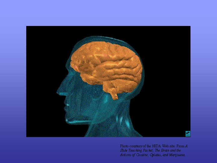 Photo courtesy of the NIDA Web site. From A Slide Teaching Packet: The Brain
