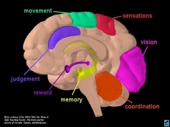 Photo courtesy of the NIDA Web site. From A Slide Teaching Packet: The Brain