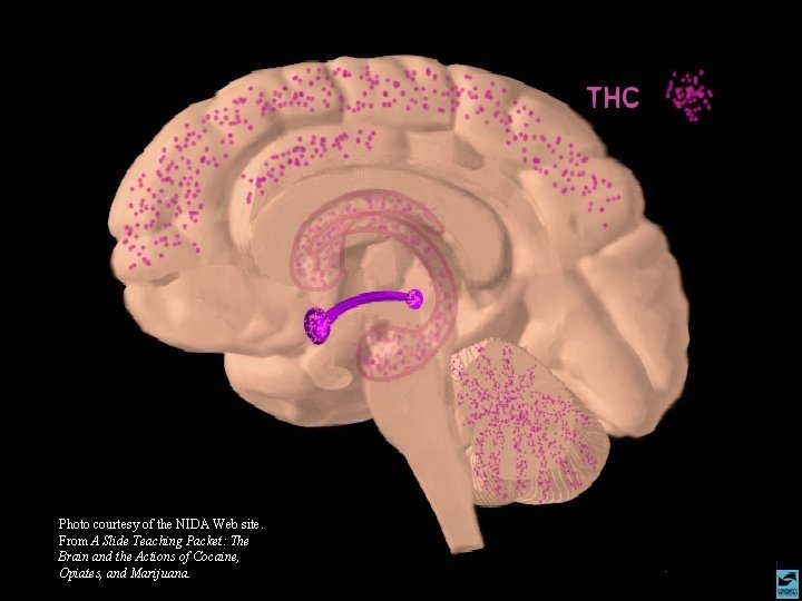 Photo courtesy of the NIDA Web site. From A Slide Teaching Packet: The Brain