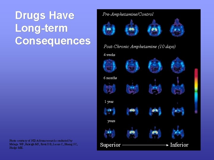 Drugs Have Long-term Consequences Photo courtesy of NIDA from research conducted by Melega WP,