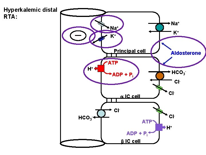 Hyperkalemic distal RTA: Na+ K+ K+ Principal cell Aldosterone ATP H+ HCO 3 -