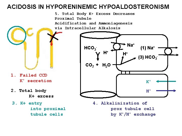 ACIDOSIS IN HYPORENINEMIC HYPOALDOSTERONISM 5. Total Body K+ Excess Decreases Proximal Tubule Acidification and