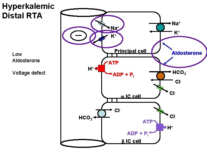 Hyperkalemic Distal RTA Na+ K+ K+ Principal cell Low Aldosterone Voltage defect Aldosterone ATP