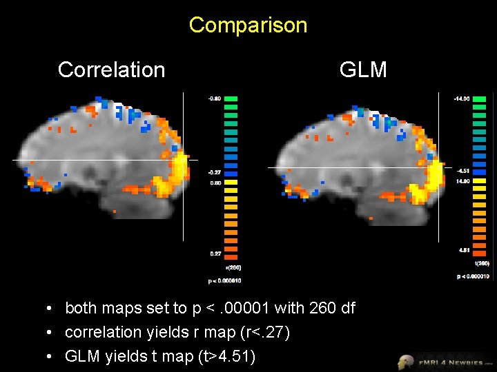 Comparison Correlation GLM • both maps set to p <. 00001 with 260 df