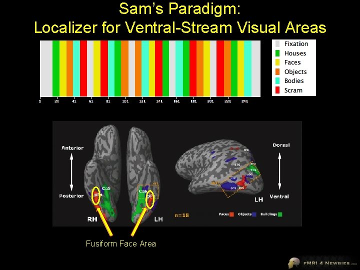 Sam’s Paradigm: Localizer for Ventral-Stream Visual Areas Fusiform Face Area 