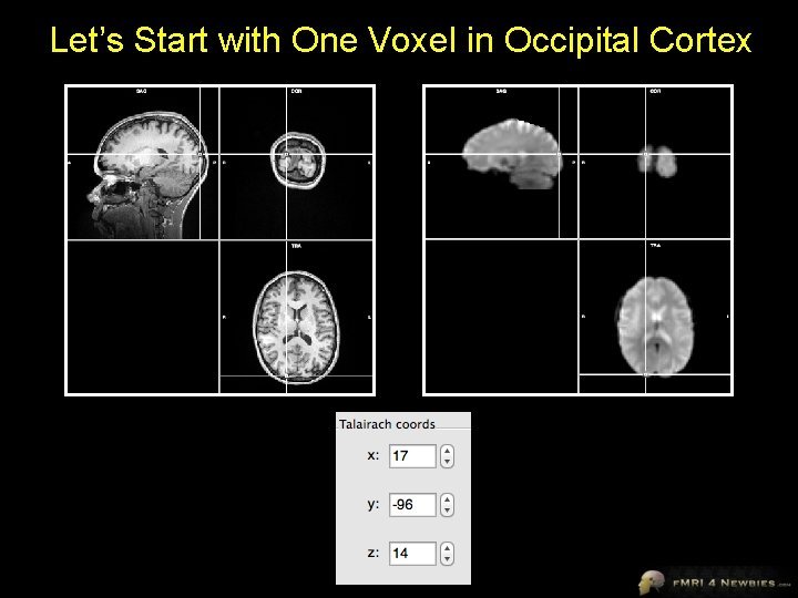 Let’s Start with One Voxel in Occipital Cortex 