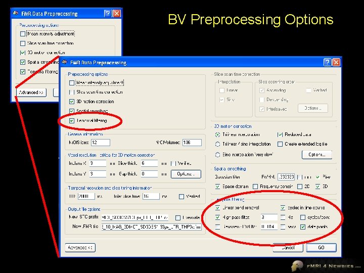 BV Preprocessing Options 
