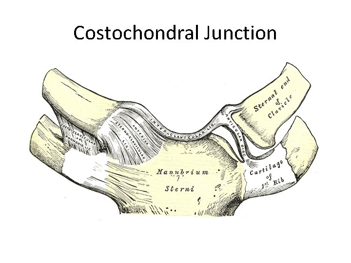 Costochondral Junction 