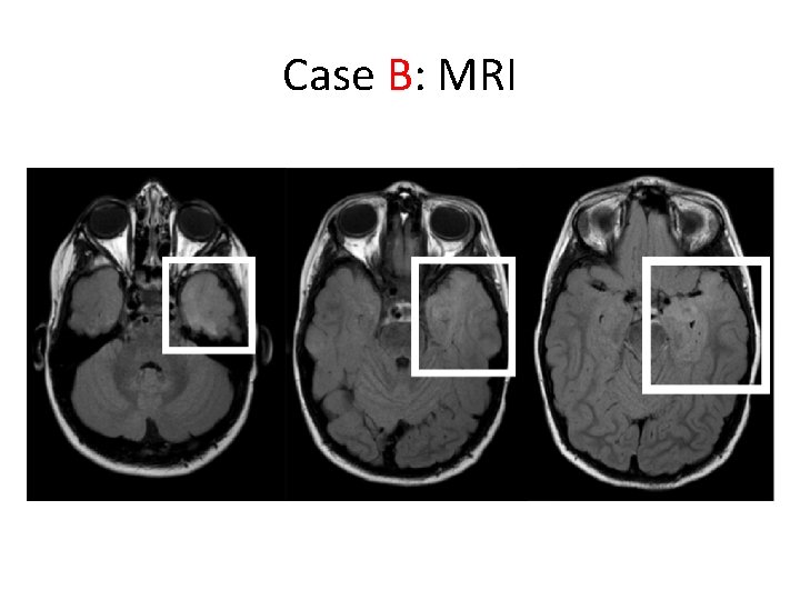 Case B: MRI 