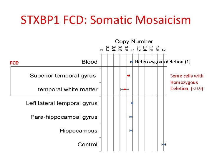 STXBP 1 FCD: Somatic Mosaicism FCD Heterozygous deletion, (1) Some cells with Homozygous Deletion,
