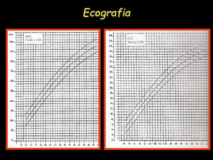 Ecografia 