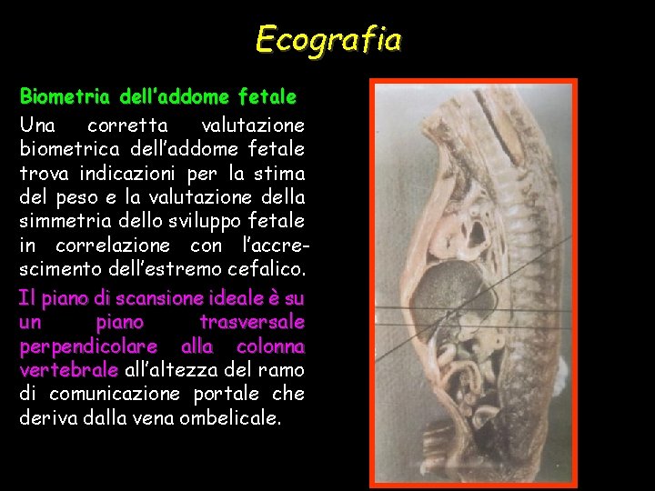 Ecografia Biometria dell’addome fetale Una corretta valutazione biometrica dell’addome fetale trova indicazioni per la