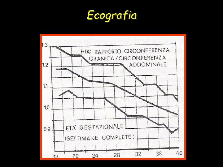 Ecografia 