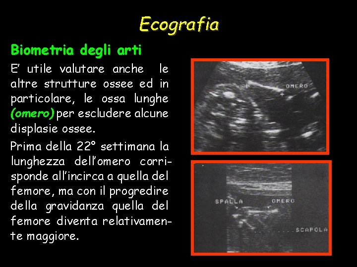 Ecografia Biometria degli arti E’ utile valutare anche le altre strutture ossee ed in