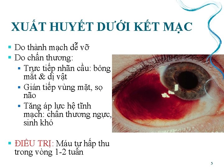 XUẤT HUYẾT DƯỚI KẾT MẠC § Do thành mạch dễ vỡ § Do chấn