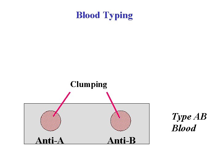 Blood Typing Clumping Type AB Blood Anti-A Anti-B 