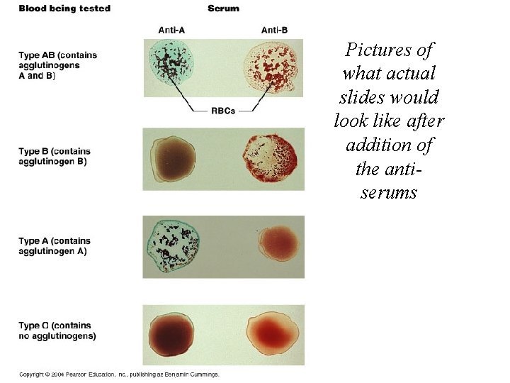Pictures of what actual slides would look like after addition of the antiserums Pictures of what actual slides would look like after addition of the antiserums