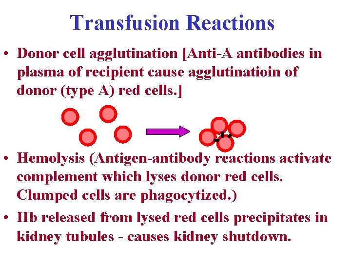 Transfusion Reactions • Donor cell agglutination [Anti-A antibodies in plasma of recipient cause agglutinatioin