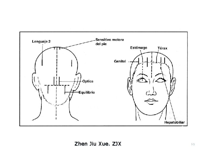 Zhen Jiu Xue. ZJX 90 