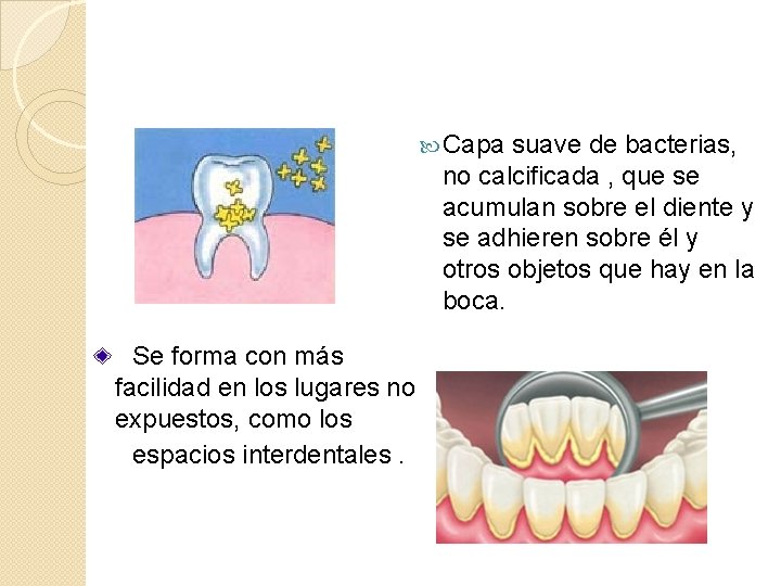 Capa suave de bacterias, no calcificada , que se acumulan sobre el diente