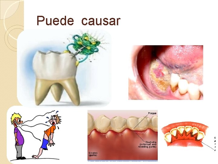 Puede causar 