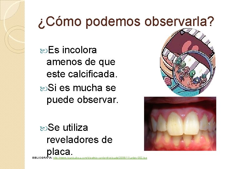 ¿Cómo podemos observarla? Es incolora amenos de que este calcificada. Si es mucha se