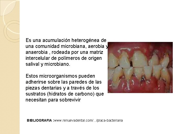 Es una acumulación heterogénea de una comunidad microbiana, aerobia y anaerobia , rodeada por