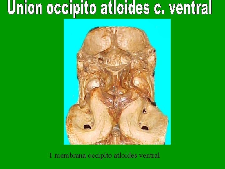 1 1 membrana occipito atloides ventral 