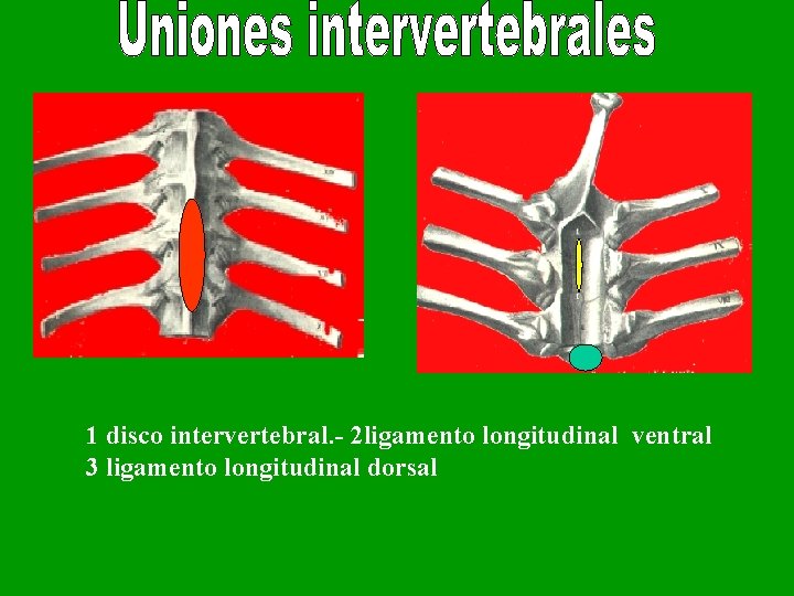 1 disco intervertebral. - 2 ligamento longitudinal ventral 3 ligamento longitudinal dorsal 