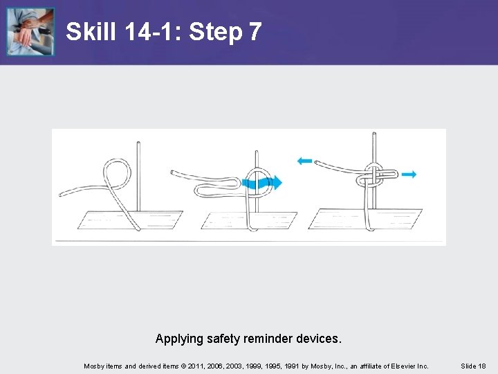 Skill 14 -1: Step 7 Applying safety reminder devices. Mosby items and derived items Skill 14 -1: Step 7 Applying safety reminder devices. Mosby items and derived items