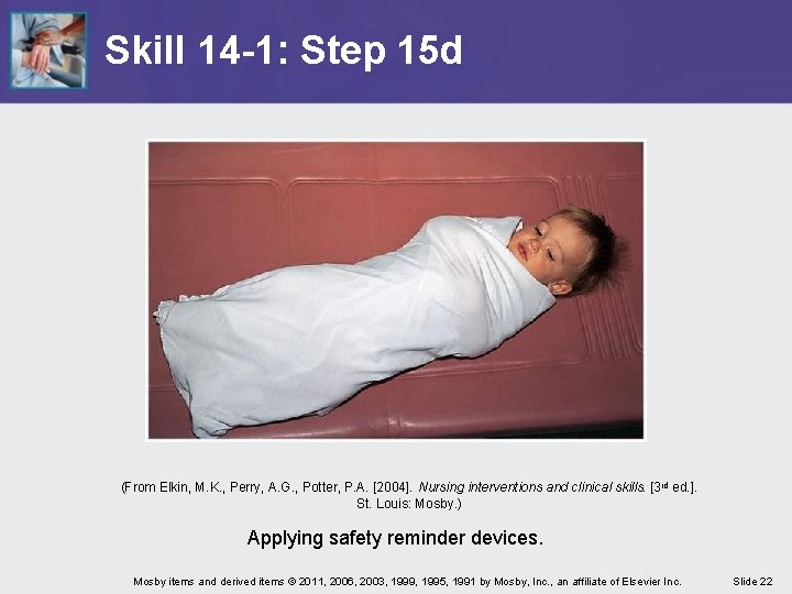 Skill 14 -1: Step 15 d (From Elkin, M. K. , Perry, A. G. Skill 14 -1: Step 15 d (From Elkin, M. K. , Perry, A. G.