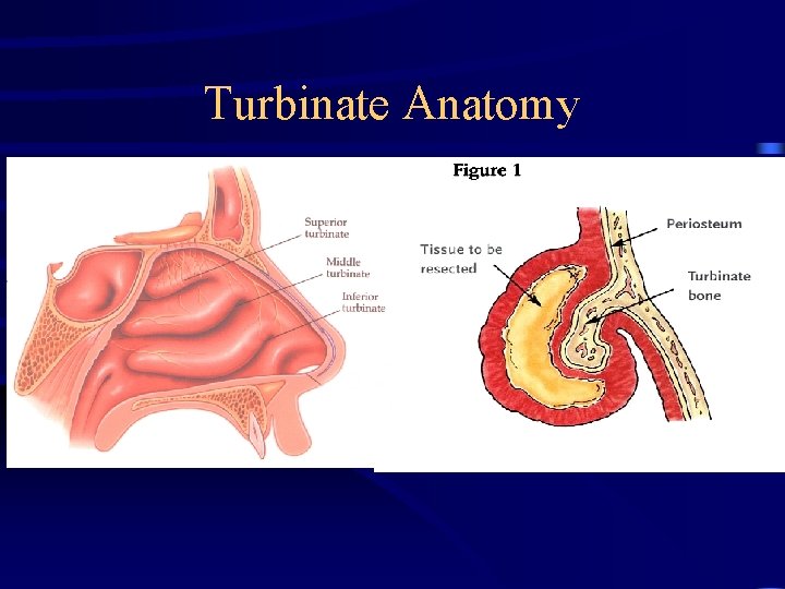 Turbinate Anatomy 