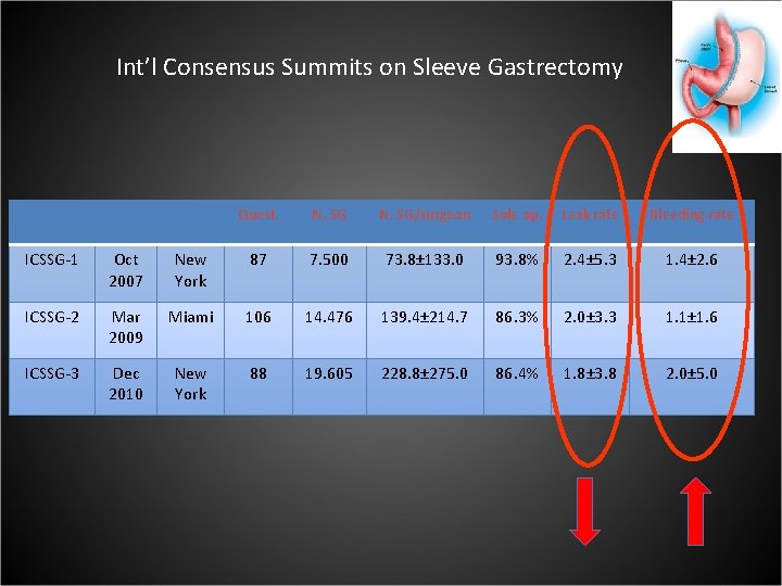 Int’l Consensus Summits on Sleeve Gastrectomy Quest. N. SG/surgeon Sole op. Leak rate Bleeding