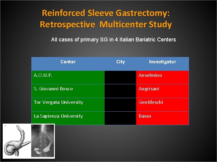 Reinforced Sleeve Gastrectomy: Retrospective Multicenter Study All cases of primary SG in 4 Italian