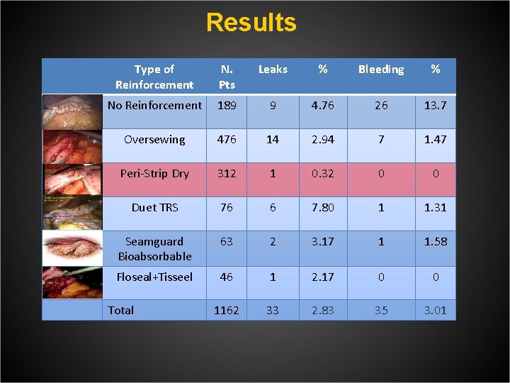 Results Type of Reinforcement N. Pts Leaks % Bleeding % No Reinforcement 189 9