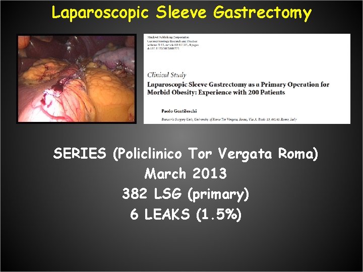 Laparoscopic Sleeve Gastrectomy SERIES (Policlinico Tor Vergata Roma) March 2013 382 LSG (primary) 6