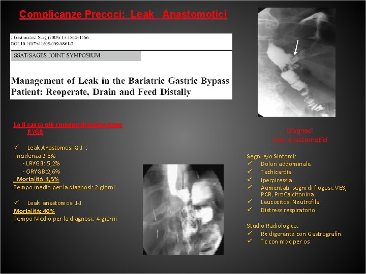 Complicanze Precoci: Leak Anastomotici La II causa più comune di morte dopo RYGB ü