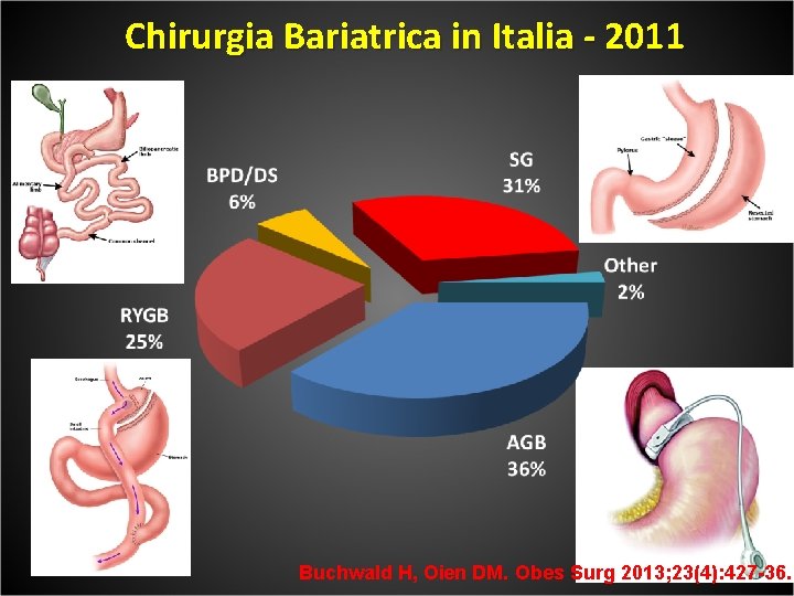 Chirurgia Bariatrica in Italia - 2011 Buchwald H, Oien DM. Obes Surg 2013; 23(4):