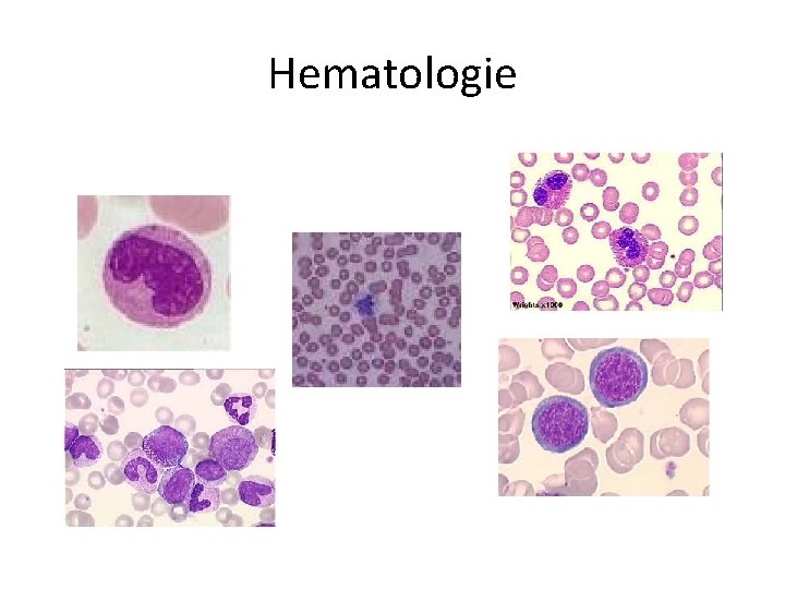 Hematologie 