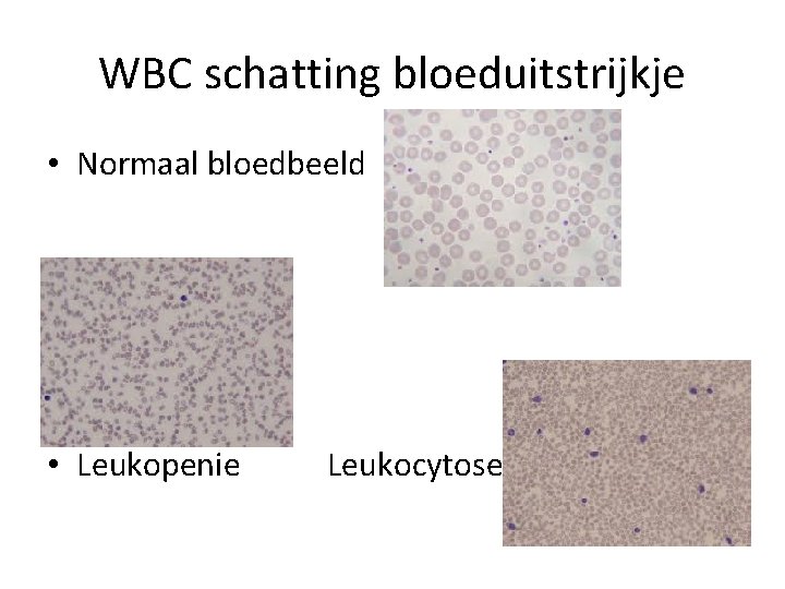 WBC schatting bloeduitstrijkje • Normaal bloedbeeld • Leukopenie Leukocytose 