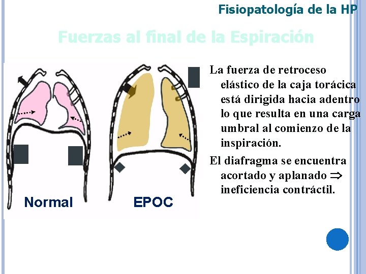 Fisiopatología de la HP Fuerzas al final de la Espiración Normal EPOC La fuerza