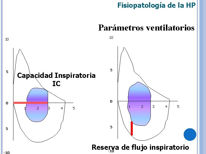 Fisiopatología de la HP Parámetros ventilatorios 10 10 5 Capacidad Inspiratoria IC 0 0