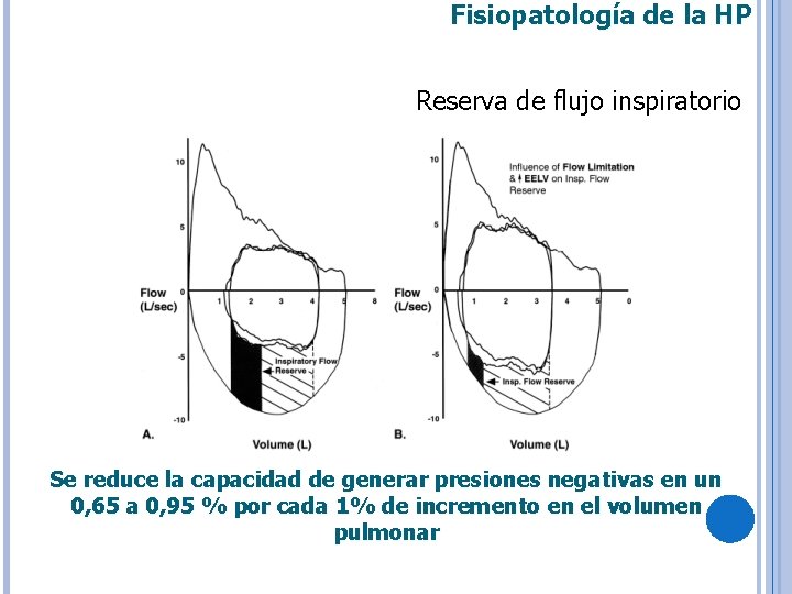 Fisiopatología de la HP Reserva de flujo inspiratorio Se reduce la capacidad de generar