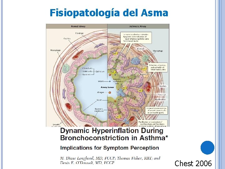 Fisiopatología del Asma Chest 2006 