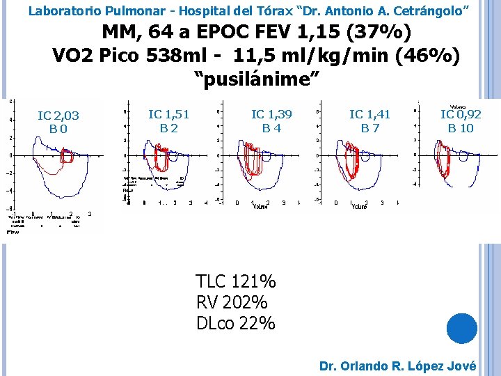 Laboratorio Pulmonar - Hospital del Tórax “Dr. Antonio A. Cetrángolo” MM, 64 a EPOC