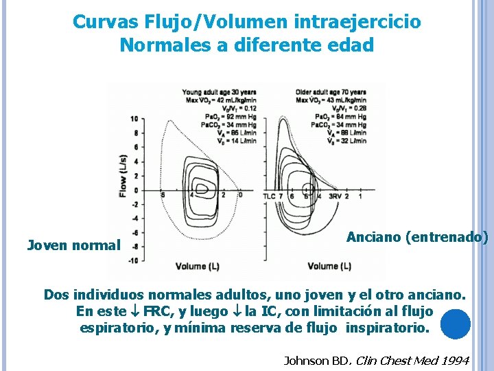 Curvas Flujo/Volumen intraejercicio Normales a diferente edad Joven normal Anciano (entrenado) Dos individuos normales